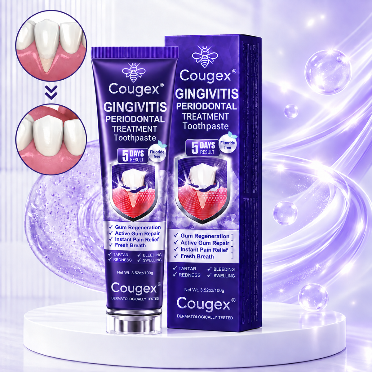 Gingivitis Periodontal Treatment Toothpaste